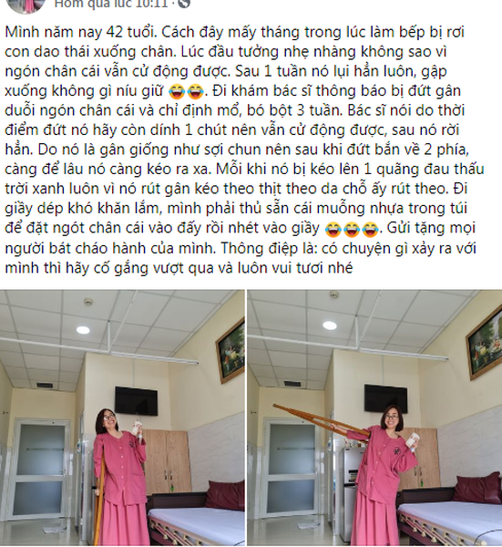 Mới đây trong một hội nhóm các thành viên đặc biệt chú ý đến bài đăng của một người phụ nữ nay đã 42 tuổi. Theo như chia sẻ chị cho biết, trong một lần làm bếp, chị đã gặp tai nạn đứt gân duỗi ngón chân cái, phải can thiệp bằng biện pháp mổ rồi  bó bột ba tuần. Ảnh: Chụp màn hình