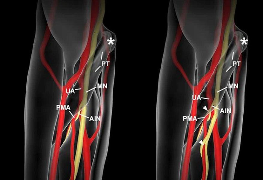 Tiến hóa là quá trình hoàn thiện, biến đổi dần để hoàn thiện hơn các bộ phận, chức năng của các sinh vật để phù hợp hơn với điều kiện sinh tốn cũng đang dần thay đổi.