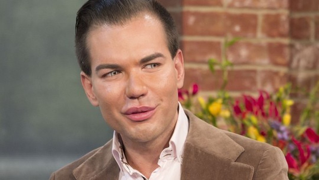 Để có được ngoại hình như một búp bê sống, anh chàng người Brazil Rodrigo Alves đã biến mình thành một con nghiện phẫu thuật thẩm mỹ vô độ.