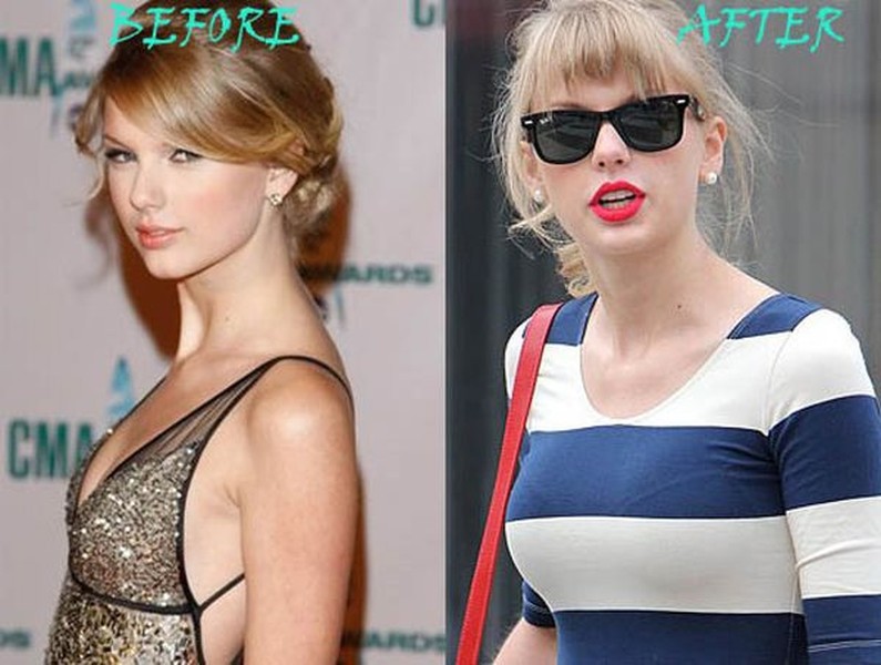 Từ năm 2012,  Taylor Swift đã bị săm soi chuyện bơm ngực khi so sánh hình ảnh cô năm 2010 và hai năm sau đó.