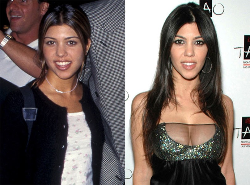 Kourtney Kardashian là người duy nhất trong 5 chị em gái Kim Kardashian thừa nhận đã nâng ngực. (Ảnh: Enews)