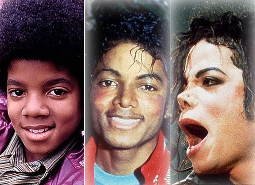  Michael Jackson được biết đến là ông hoàng của nền nhạc pop thế giới và có sức ảnh hưởng to lớn đến nền công nghiệp âm nhạc toàn cầu. Bên cạnh đó, Michael Jackson cũng gây ồn ào với hành động cấy ghép trở thành người da trắng, khi xuất thân của ông là người da màu. Dưới đây là những hình ảnh của Jackson biến đổi theo năm tháng, kể từ khi ông còn là anh chàng tuổi teen cho đến lúc gương mặt bắt đầu biến dạng sau nhiều năm "dao kéo".