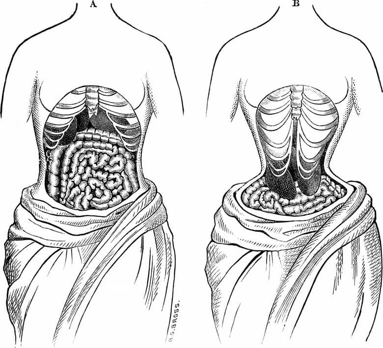 Vòng eo siêu nhỏ là một trong những chiêu làm đẹp kinh dị nhất lịch sử loài người từ trước đến nay. Để làm đẹp theo cách này, người con gái cần phải đeo nẹp ngay từ khi còn nhỏ và ảnh hưởng rất lớn tới sự phát triển của nội tạng.