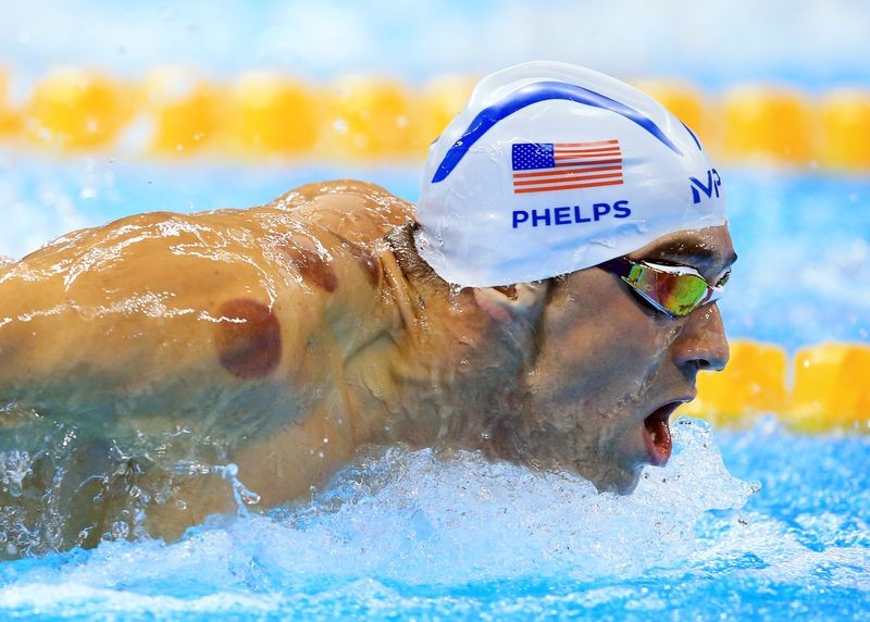 Tại đại hội thể thao Olympic 2016, khi vận động viên bơi lội nổi tiếng giới Michael Phelps xuống nước để thực hiện bài thi bơi, nhiều người chú ý đã chú ý đến những vệt tròn màu tím trên vai kình ngư này. Những vòng tròn màu đỏ đó do  giác hơi, một phương pháp tuy không còn xa lạ ở Việt Nam nhưng gần đây được nhiều vận động viên nổi tiếng thế giới thực hiện để hồi phục nhanh hơn và thi đấu tốt hơn.  