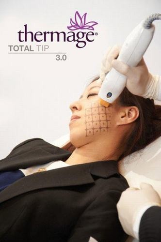 Trẻ hơn 10 tuổi nhờ công nghệ Thermage