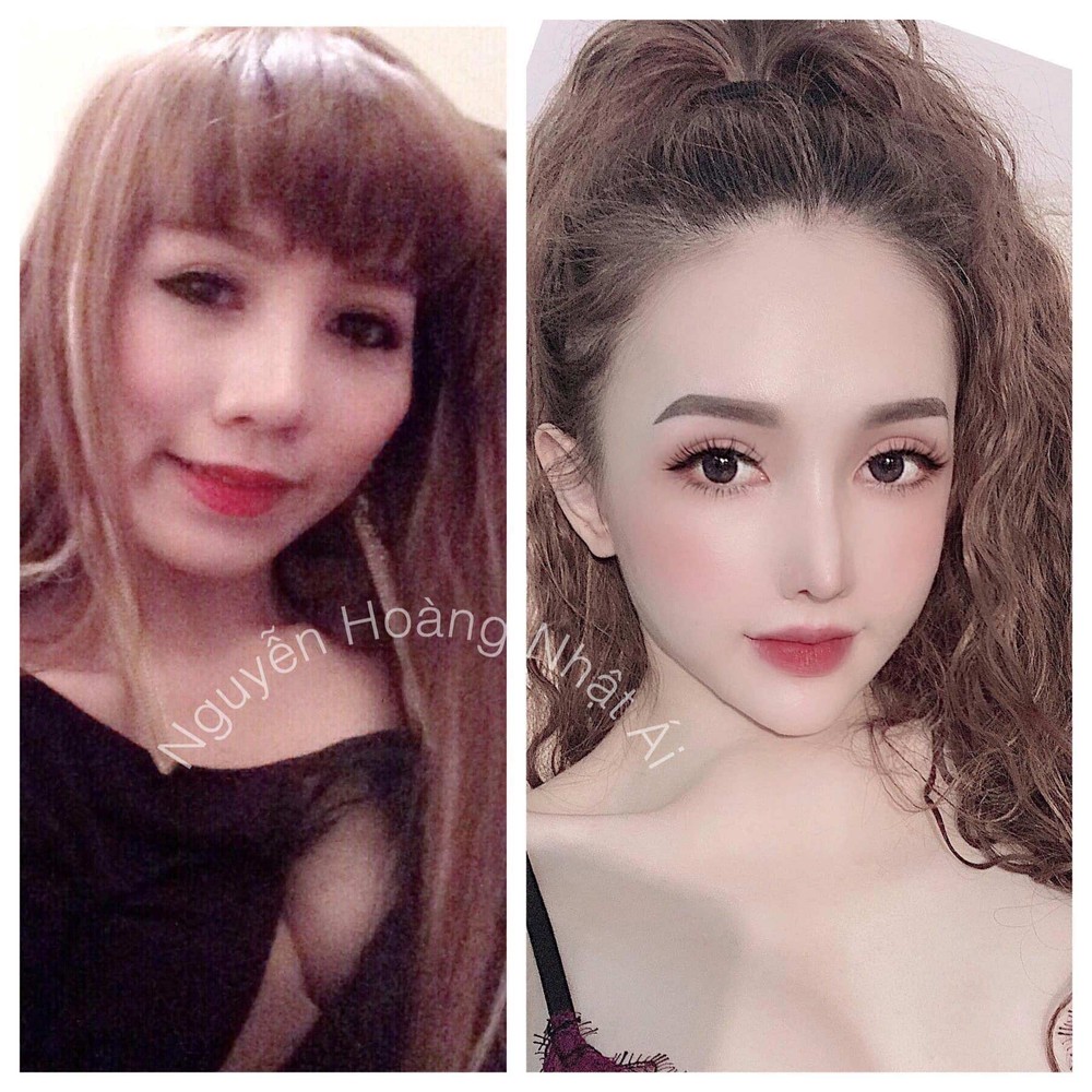  Hot girl Nguyễn Hoàng Nhật Ái (sinh năm 1992) từng gây sốt trên MXH nhờ hành trình phẫu thuật thẩm mỹ để trở thành một cô gái xinh đẹp khi bị người yêu chia tay với lý do... quá xấu.