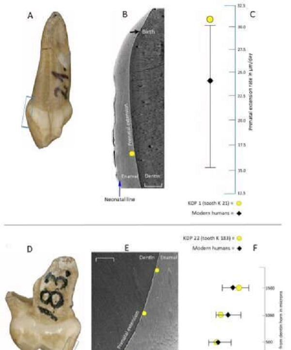 Chiếc răng sữa hóa thạch của một đứa trẻ thuộc loài người cổ Neanderthals chết non đã được bảo quản nguyên vẹn ở một di chỉ tại Krapina, Croatia ngày nay. Điều đặc biệt là nó phát triền hơn nhiều so với tuổi thật của đứa bé.