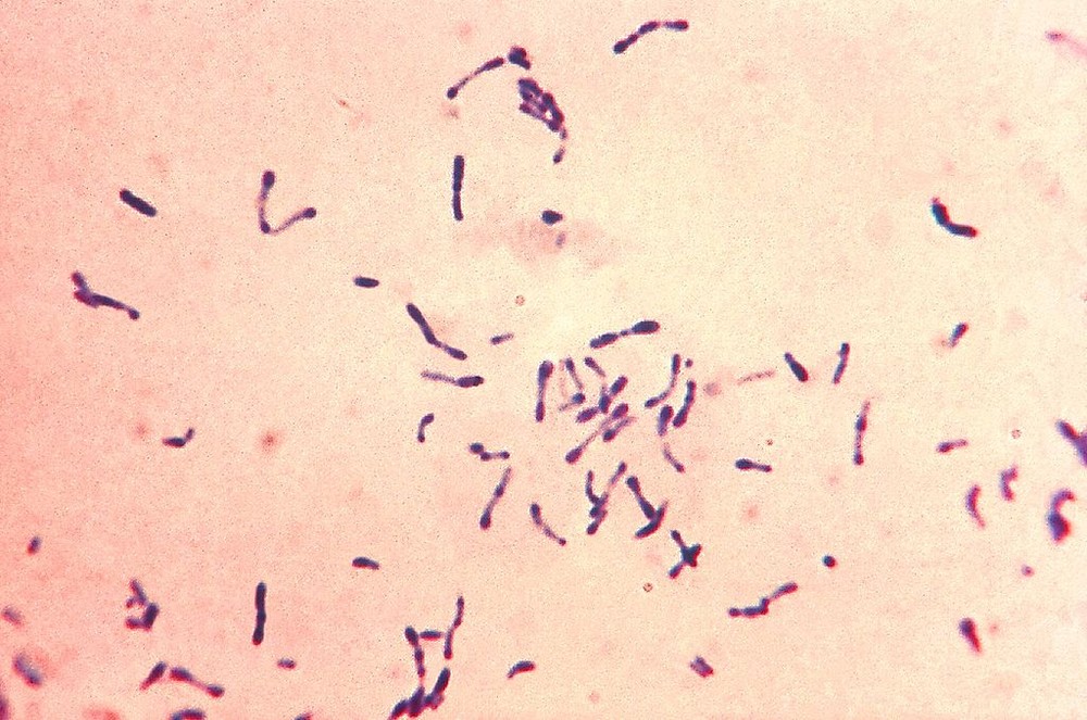 Corynebacterium diphtheriae là vi khuẩn gây ra  bệnh bạch hầu. Vi khuẩn có thể xâm nhập vào hầu họng ở những cá thể nhạy cảm. Tại đây tiết ra độc tố có khả năng ức chế quá trình tổng hợp của tế bào do đó làm chết tế bào và hình thành các màng giả tại chỗ.