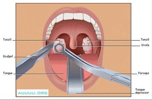 Bé trai Solomon Womack, ở bang Wisconsin, Hoa Kỳ đã được  phẫu thuật cắt amidan vào ngày 9/2 vừa qua tại một bệnh viện ngoại trú. Sau khi phẫu thuật, sức khỏe vẫn của em vẫn không vấn đề gì.