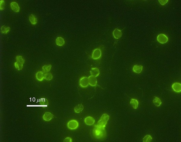 Trùng bao tử cryptosporidium được biết đến như một loại sinh vật đơn bào, khi ăn phải thức ăn hoặc nước uống có chứa loại thực phẩm này có thể gây tiêu chảy, suy giảm miễn dịch, gây tổn thương nặng ở ruột, ngay cả những kỹ thuật lọc nước tiên tiến nhất cũng khó mà loại bỏ hoàn toàn loại vi khuẩn này.