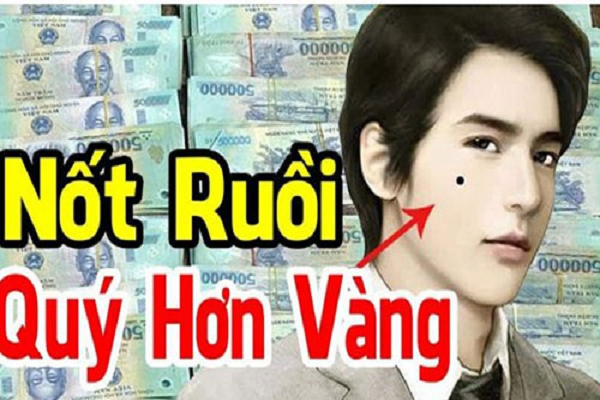 Nốt ruồi “ngàn vàng khó mua”, ai sở hữu thì giàu sang 1 đời