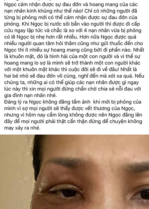 Gương mặt của  Hồng Ngọc bị bỏng nặng vào ngày 9/5. Ngoài mặt, ngực và cánh tay của nữ ca sĩ cũng bị ảnh hưởng.