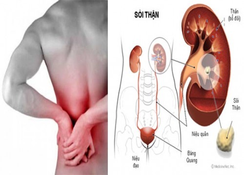 Dưới đây là những loại quả có thể chữa trị bệnh sỏi thận mà bạn có thể dễ dàng kiếm được.