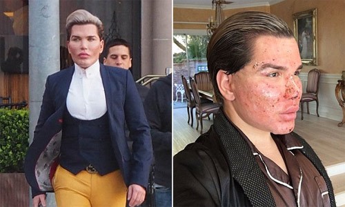 Rodrigo Alves phá nát mặt vì muốn làm búp bê sống Ken