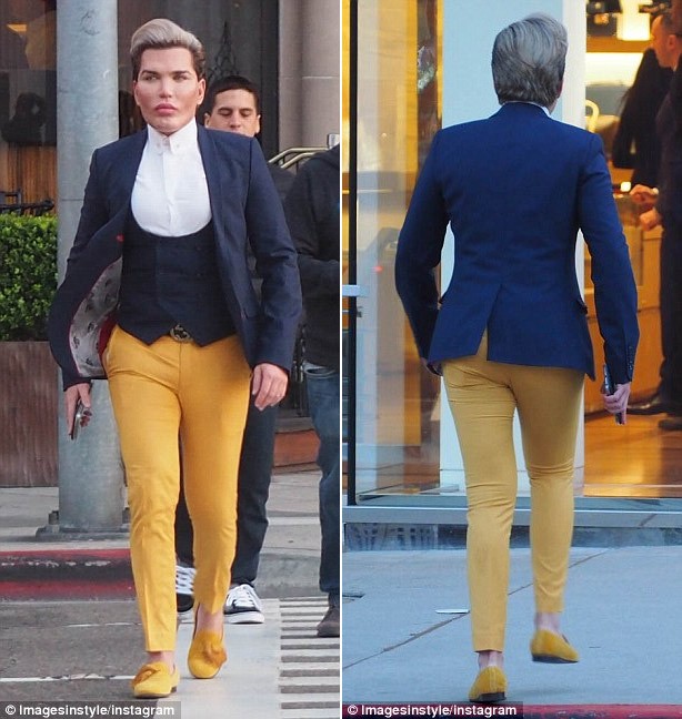  Búp bê sống Ken, Rodrigo Alves đã phải phẫu thuật thêm một lần nữa để giảm thiểu những vết sẹo và thu nhỏ lỗ chân lông trên mặt. Đây là lần phẫu thuật thứ 51 của anh. (Ảnh: Instagram)