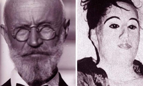 Bác sĩ Carl Tanzler là một trong những người gây ra vụ  trộm tử thi gây chấn động thế giới. Sinh năm 1877 tại Dresden (Đức), Tanzler đem lòng yêu say đắm nữ bệnh nhân Maria Elena Milagro “Helen” de Hoys. Vị bác sĩ này từng thổ lộ tình yêu với Maria nhưng bị từ chối. Về sau, cô qua đời vì lao phổi.