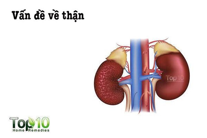 Vấn đề về thận: Nhiều nghiên cứu cho thấy lạm dụng  thuốc giảm đau sẽ gây ra các vấn đề về thận. Với việc sử dụng thuốc giảm đau như ibuprofen hoặc naproxen liên tục, một số người thậm chí có thể bị suy thận. Tuy nhiên, điều này xảy ra nhiều hơn ở những người bị tiểu đường hoặc cao huyết áp.