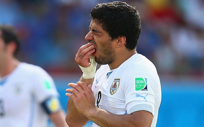 Luis Suarez và điều khoản cấm cắn. Cho dù người trong cuộc phủ nhận, thì giới thạo tin vẫn một mực rằng Barcelona đã phải cài cắm một điều khoản đặc biệt khi kí hợp đồng với Luis Suarez: Không được cắn người. Cắn người là Suarez bị phạt rất nặng. Barca đã quá sợ khi thấy Suarez cắn người 3 lần trong quá khứ. Và cứ sau mỗi lần cắn ai đó thì anh lại đòi ra đi.