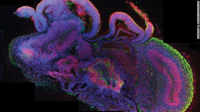 Các nhà khoa học vừa mới tạo ra những gì được gọi là "các cơ quan tế bào não" (cerebral organoids) bằng cách sử dụng các tế bào gốc. Các cấu trúc nhỏ bằng hạt đậu được tạo nên từ mô não của con người, và chúng có thể giúp các nhà nghiên cứu khám phá những câu hỏi quan trọng về sự phát triển não và sự rối loạn xảy ra trong những giai đoạn đầu tiên của đời người.