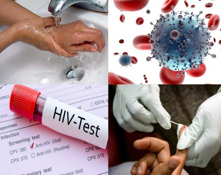 Ngay khi phát hiện phơi nhiễm HIV, cần phải làm gì?