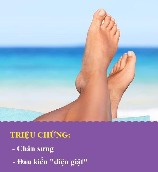 Rối loạn thận: Nếu thận không hoạt động bình thường, chất lỏng dư thừa sẽ khó thoát ra khỏi cơ thể. Điều này có thể gây phù nề trên cơ thể. Nếu khu vực xung quanh mắt bị sưng hoặc bạn cảm thấy đau giống như "điện giật" ở các chi, đó có thể là dấu hiệu cảnh báo thận có vấn đề.