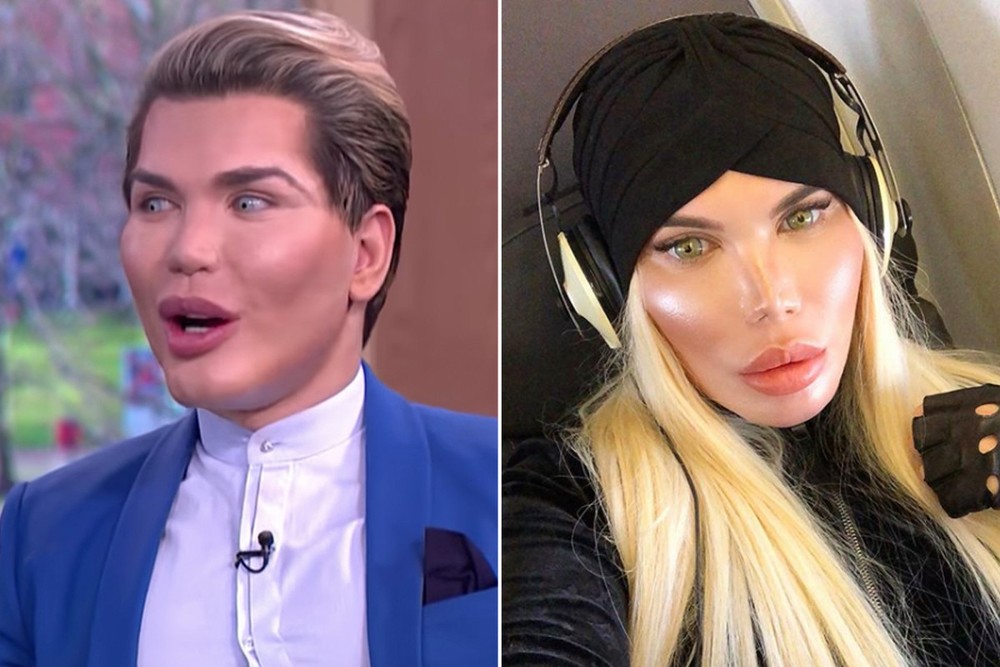 Rodrigo Alves, sống ở London (Anh) được mệnh danh là "búp bê sống" Ken sau khi trải qua hàng chục ca phẫu thuật để có được diện mạo hoàn mỹ nhưng giờ đây, anh tiết lộ đang  chuyển giới thành phụ nữ.