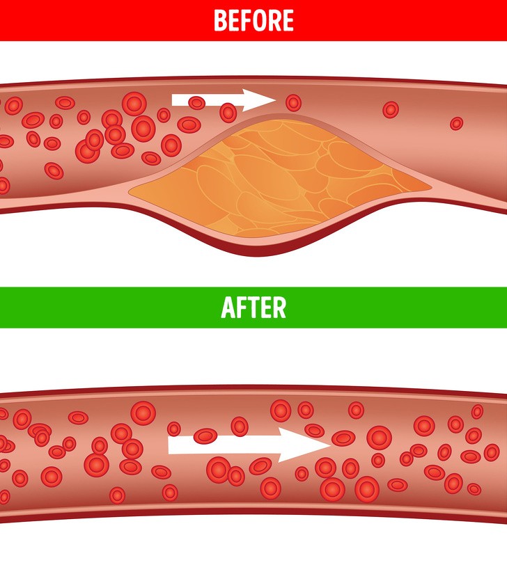 Giảm cholesterol: Đu đủ rất giàu chất xơ, giúp làm giảm cholesterol. Nó cũng chứa các chất chống oxy hóa và vitamin có tác dụng tốt trong việc ngăn ngừa bệnh tim.