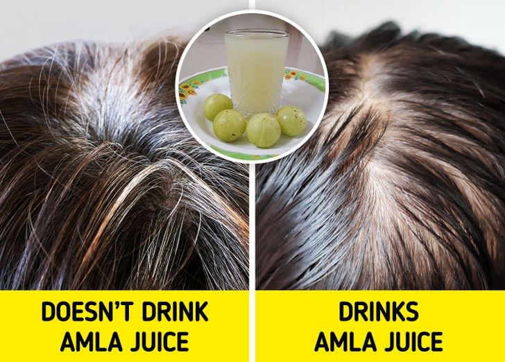 1. Amla (trái cây Ấn Độ): Uống một cốc nước ép quả amla mỗi ngày có nhiều lợi ích cho sức khỏe vì nó giàu vitamin C và các chất chống oxy hóa khác. Quả amla có thể chống lại các gốc tự do làm hỏng tóc của chúng ta và dẫn đến tóc bạc. Bạn cũng có thể sử dụng dầu amla bôi trực tiếp lên tóc để thúc đẩy sự phát triển của tóc, cũng như giữ màu tóc đen nhánh.