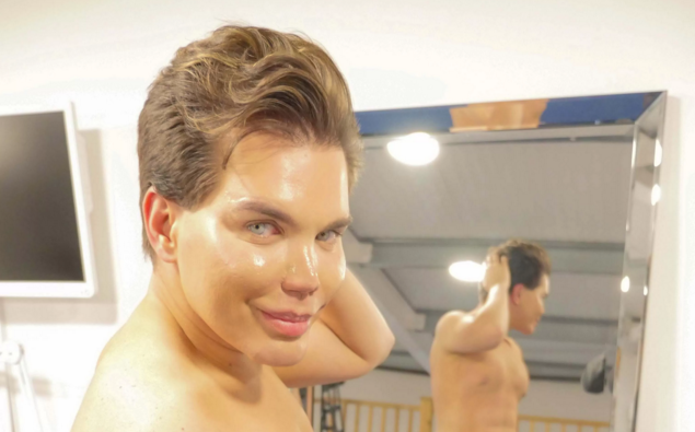 "Búp bê Ken" phiên bản đời thực Rodrigo Alves phải từ bỏ niềm đam mê phẫu thuật thẩm mỹ sau khi trải qua 43 lần  phẫu thuật thẩm mỹ để giống bạn trai của búp bê Barbie. Lý do vì gương mặt của anh gần như bị hủy hoại hoàn toàn khi phẫu thuật sửa mũi lần thứ 6. Rodrigo Alves đến từ Brazil đã chi hơn 350,000 bảng Anh (10,5 tỷ VND) để phẫu thuật thẩm mỹ giống búp bê Ken (bạn trai của Barbie). Trong lần sửa mũi gần đây nhất, anh bị nhiễm trùng và được nhận số tiền bảo hiểm là 1 triệu bảng Anh (hơn 29 tỷ 201 triệu đồng).