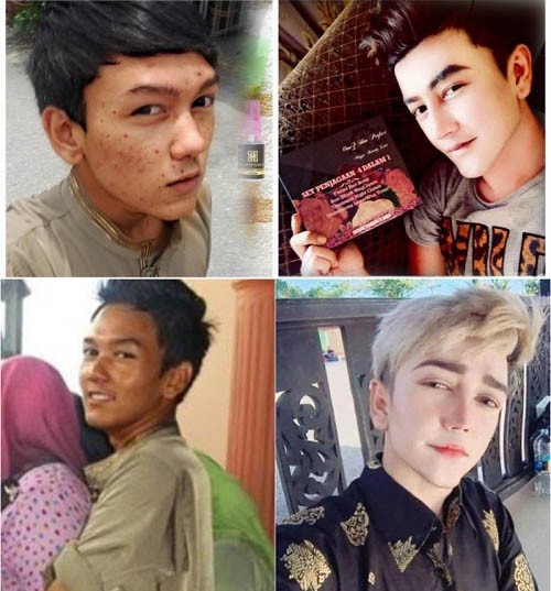  Hot boy Malaysia Amirul Rizwan Musa, 21 tuổi gây xôn xao cộng đồng mạng Malaysia khi tiết lộ chuyện tiêu tốn 1,4 tỷ đồng để ra nước ngoài, phẫu thuật thẩm mỹ giống nhân vật hoạt hình. Ban đầu, ai cũng ngỡ ngàng, khó tin nhưng rồi quay sang chỉ trích vẻ đẹp không tự nhiên của Musa. Ngay đến cả người thân cũng không hài lòng về việc anh bỏ ra số tiền quá lớn cho việc "lột xác".