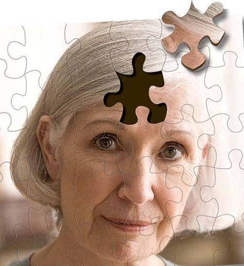 Alzheimer là dạng thoái hóa não nguyên phát, hiện chưa rõ căn nguyên gây bệnh. Khi mắc, người bệnh thường bị mất trí khó phục hồi. Bệnh chủ yếu xuất hiện ở người trên 65 tuổi.