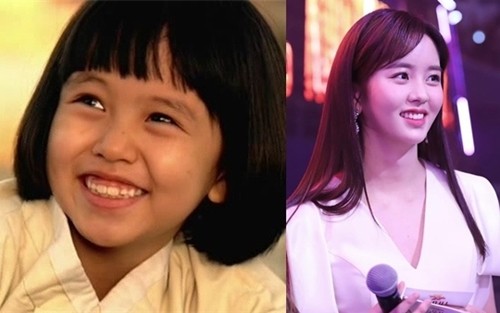 Ở tuổi 20,  mỹ nhân Hàn Kim So Hyun khiến người ta kinh ngạc bởi nhan sắc tựa nữ thần, trong khi ngày bé, cô đen nhẻm, kém sắc, thừa nhận chẳng có ai khen xinh đẹp.