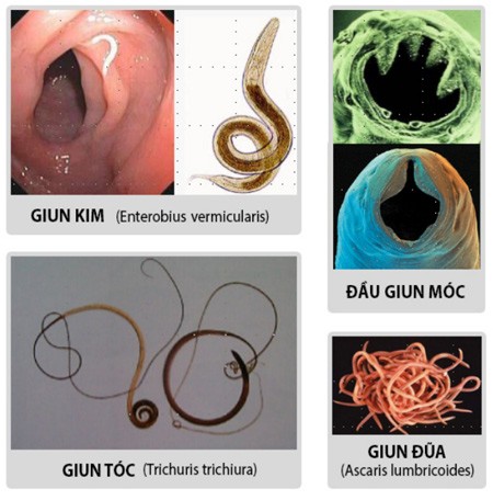 Có rất nhiều loại giun đường tiêu hóa, tuy nhiên 4 loại giun đũa, giun kim, giun tóc, sán dây là những loại khó “đối phó” nhất. Về cơ bản, giun tròn và giun tóc lây lan qua thực phẩm và nước bị ô nhiễm. Giun kim có thể truyền từ người này sang người khác và sán dây có thể xâm nhập vào cơ thể vật chủ do ăn những thực phẩm chưa chín kỹ hoặc sống như thịt. Những loại giun này cũng có thể xâm nhập vào cơ thể người từ bể bơi, nước sông, hồ hoặc do những thói quen vệ sinh và điều kiện vệ sinh kém.   