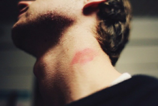 Nụ hôn tử thần hay có tên tiếng Anh " Hickey Kiss" là trào lưu đánh dấu chủ quyền của nhiều cặp đôi đang yêu nhau. Cũng từ hình thức này không ít các tai nạn đáng tiếc đã xảy ra.