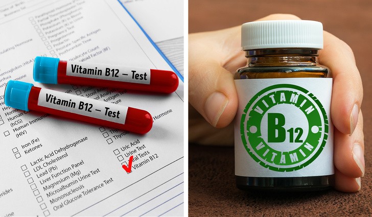 Sử dụng vitamin B-12: Bổ sung vitamin B-12 rất quan trọng đối với sự phát triển và sức khỏe của tóc. Sự thiếu hụt B-12 có thể là lý do cho tóc khô, mỏng và dễ gãy. Da đầu cũng cần vitamin B-12, nếu không thì nó có thể bị ngứa và gàu.