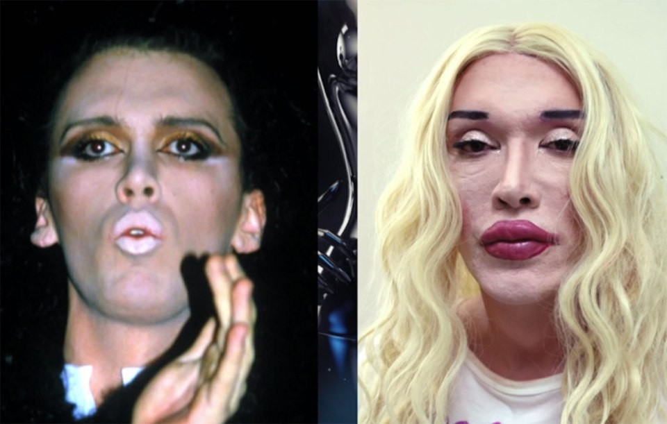 Huyền thoại nhạc pop của những năm 80 Pete Burns thú nhận đã phải trải qua hơn 300 lần phẫu thuật tái tạo hình sau khi  phẫu thuật thẩm mỹ hỏng. Chủ nhân của ca khúc “Dead or Alive” 57 tuổi đã từng suýt chết và nỗi sợ hãi này vẫn chưa qua.  