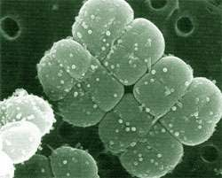 Deinococcus radiodurans, biệt danh "Vi khuẩn Conan", là loài  vi khuẩn chịu bức xạ mạnh nhất trên Trái Đất, sống sót trong môi trường bức xạ cao gấp hàng nghìn lần mức con người chịu đựng. (Ảnh: European Synchrotron Radiation Facility)