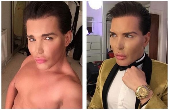 Rodrigo Alves (32 tuổi - người Anh) phẫu thuật thẩm mỹ tổng cộng 42 lần từ năm 2004 để giống "búp bê Ken". 