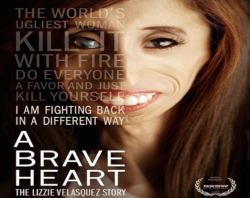 Lizzie Velasquez, 26 tuổi, người Mỹ, mắc hội chứng lão hóa sớm của trẻ sơ sinh. Tuổi thơ của cô luôn gặp phải chịu sự chế giễu vì nhan sắc khác thường của mình. Tuy vậy, không chịu khuất phục trước số phận, Lizzie dũng cảm đối diện với tất cả mọi lời đùa ác ý, phấn đấu không ngừng để trở thành một diễn thuyết gia, nhằm truyền cảm hứng cho nhiều người để lấy lại niềm tin của họ.