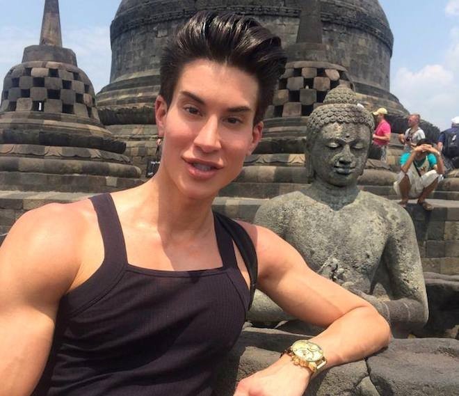 Justin Jedlica gây chú ý khi có ngoại hình giống hệt búp bê. Anh được mệnh danh là búp bê Ken (bạn trai của Barbie) phiên bản đời thực ở thế kỷ 21.