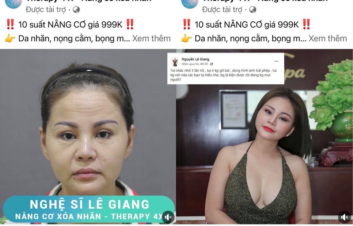 Mới đây trên trang cá nhân, nghệ sĩ hài  Lê Giang không ngừng bày tỏ sự bức xúc khi những hình ảnh của mình bị một cơ sở thẩm mỹ sử dụng để quảng cáo mà không xin phép. Thậm chí trong đó, một bức ảnh mặt mộc, da nhăn nheo kém sắc của chị còn bị một số khán giả nghi là đã qua chỉnh sửa.