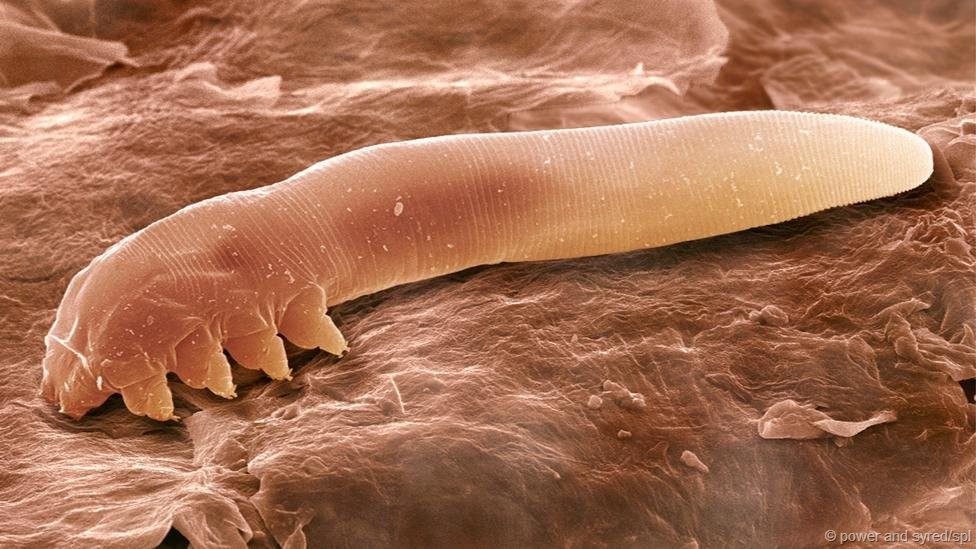  Rận Demodex có hình dạng như giun hoặc sâu không thể nhìn thấy bằng mắt thường. Bạn chỉ có thể nhìn thấy nó dưới sự trợ giúp của kính lúp hoặc kính hiển vi. Đây là loài chân khớp có họ hàng gần với ve kí sinh và nhện. 