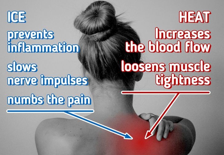 1. Liệu pháp nhiệt và đá: Trong 48 đến 72 giờ đầu tiên, các bác sĩ khuyên bạn nên chườm đá vào vùng bị đau (mỗi lần từ 10 – 20 phút). Chườm đá giúp ngăn ngừa viêm nhiễm và làm chậm các xung thần kinh, giúp làm tê cơn đau. Nếu cơ vẫn còn đau và cứng sau đó, hãy sử dụng nhiệt như tắm nước ấm, chườm nóng, … Điều này sẽ làm tăng lưu lượng máu và nới lỏng sự căng cứng của cơ.