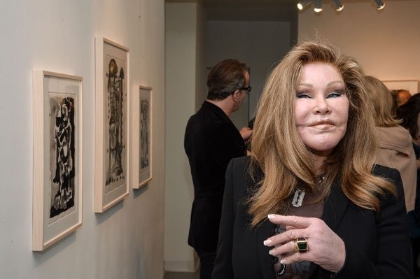 " Thảm họa dao kéo" Jocelyn Wildenstein được mệnh danh là "Catwoman - Người mèo" bởi khuôn mặt của bà biến dạng méo mó.