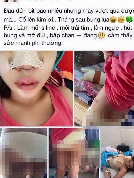 Để cải thiện được nhan sắc, tạo sự tự tin cho bản thân, cô gái trẻ tên Kim ở Hà Nội đã quyết định thực hiện "đại tu" cơ thể với một loạt ca phẫu thuật thẩm mỹ. Quá trình  phẫu thuật thẩm mỹ đầy đau đớn được cô gái trẻ công khai trên mạng và khiến nhiều người xem không khỏi rùng mình.