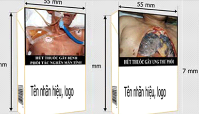 Theo quy định của Luật phòng chống tác hại thuốc lá, đã được Quốc hội thông qua, tất các các công ty sản xuất thuốc lá phải thực hiện in các hình ảnh cảnh báo về tác hại trên bao thuốc lá, với diện tích là 3/4 bao thuốc, bắt đầu từ ngày 8/8/2013, theo đó có 5 hình ảnh dưới đây là bắt buộc.