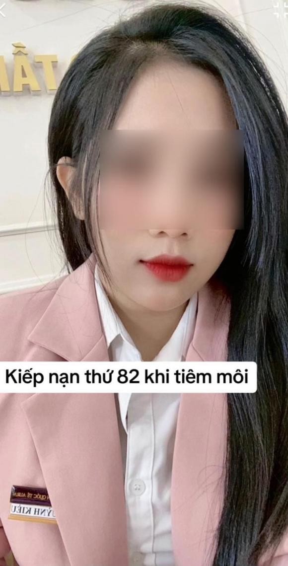 Tiêm filler môi là thủ thuật làm đẹp khá phổ biến hiện nay. Nhiều người môi mỏng, thích có đôi môi dày, căng mọng trông quyến rũ và tây hơn. Tuy nhiên, nếu chọn những nói không uy tín, hậu quả của việc tiêm môi sẽ cực nguy hiểm.