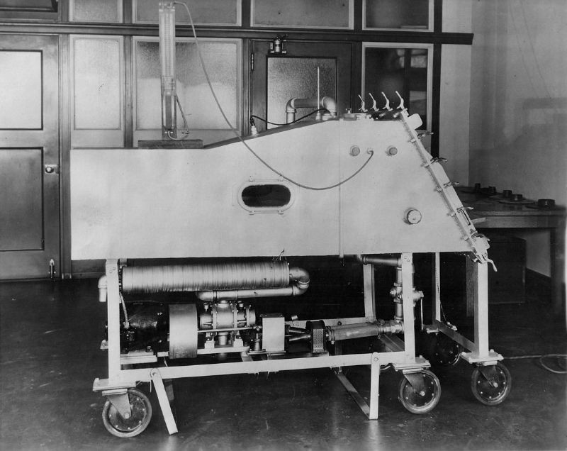 Một "Phổi thép" (Iron lungs), chiếc  máy thở hiện đại đầu tiên, tháng 9/1930. Nhà nghiên cứu y học Mỹ Philip Drinker (1894-1972) đã thiết kế ra thiết bị này vào năm 1929.