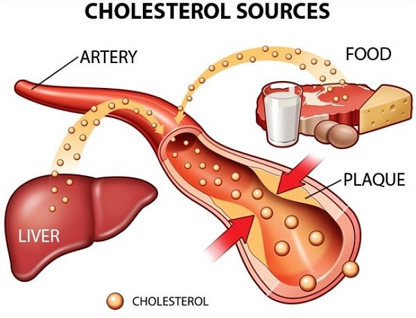 Tại sao rối loạn lipid máu nguy hiểm? 