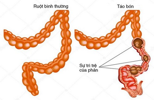 Thuốc chữa bệnh tiêu hóa gây hại... đường tiêu hóa